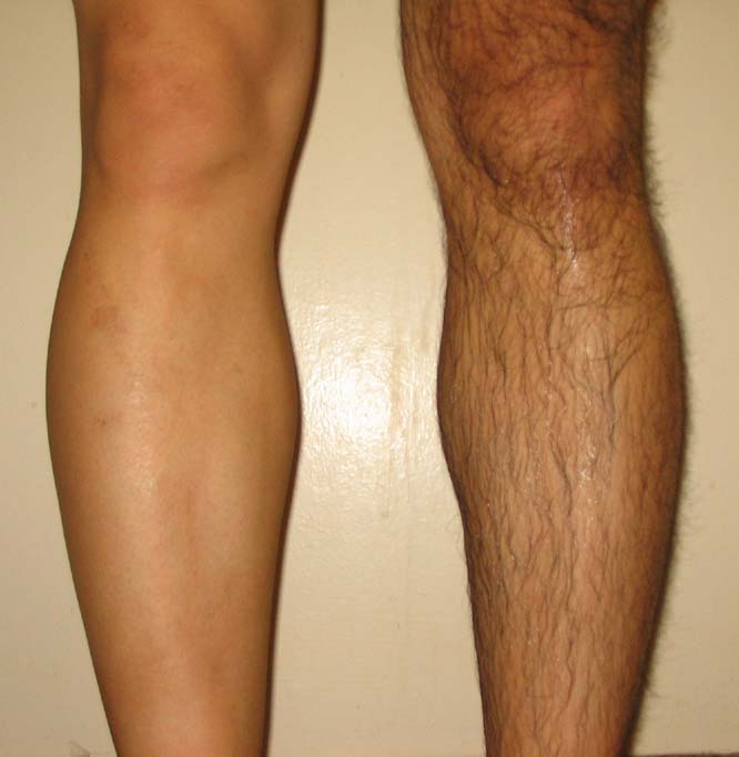 Leg male shaved